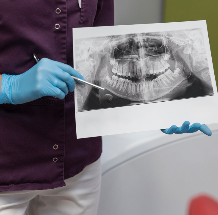 radiografía panorámica