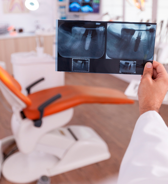 radiografía panorámica