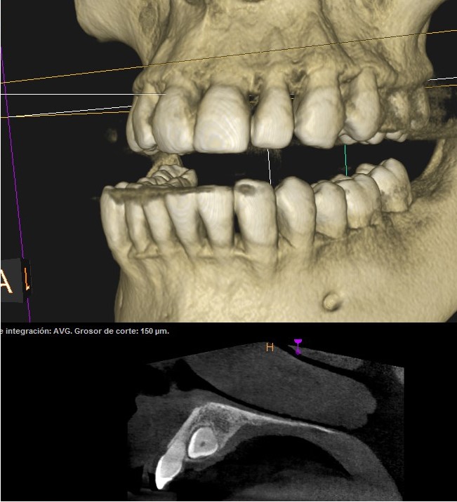 TAC Dental 3D