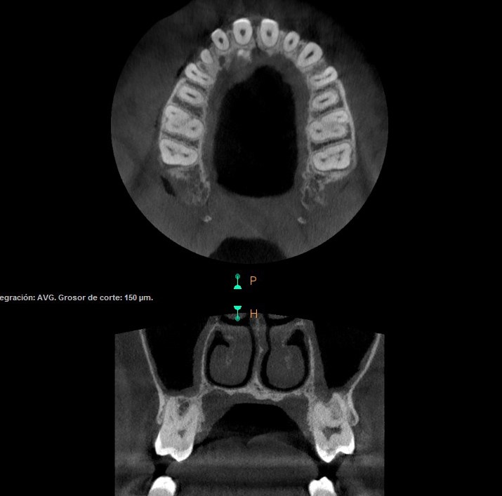 TAC Dental 3D