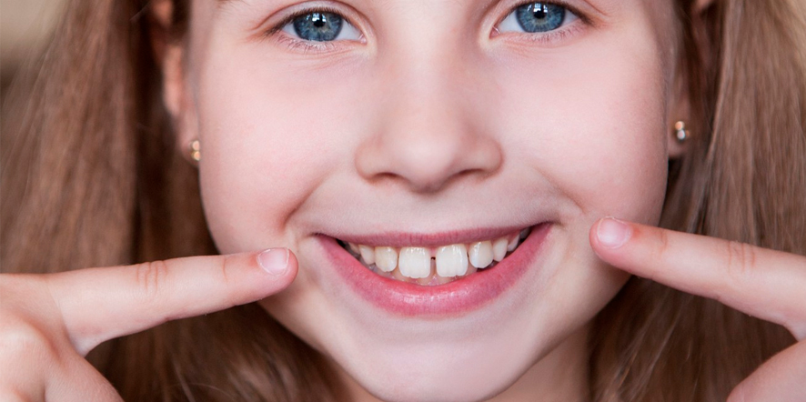 Diastema dental, descubre como cerrar el espacio entre tus dientes