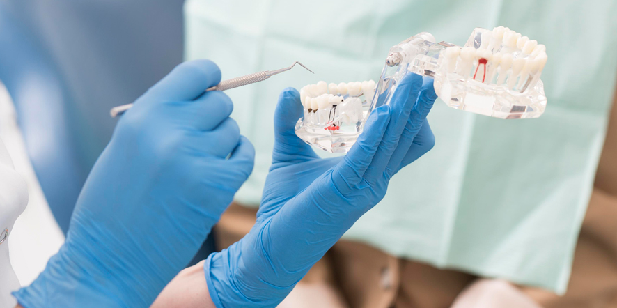Reconstrucción dental. Qué necesitas saber sobre este tratamiento